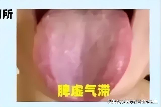 常用调理脾胃的中成药应用大全，不下十几种，看看怎么区分？