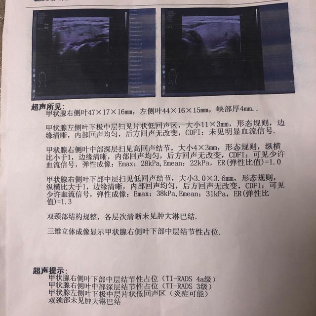 菠菜是甲状腺结节的“发物”？医生：3种绿叶菜多吃结节或可消散