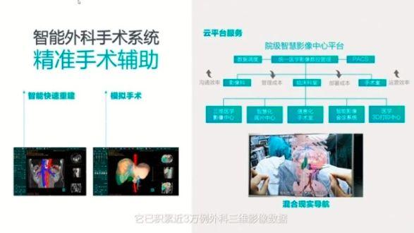 海信发布全球首款医用内窥显示器，55英寸超高清