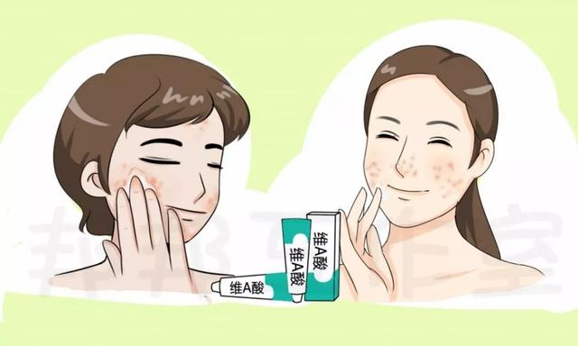 维a酸乳膏能去鼻子毛周角化