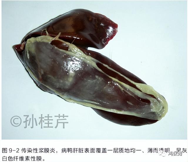 鸡皮肤是不传染