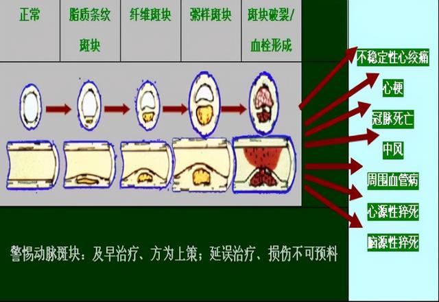 50岁大叔“斑块”消失，他坚持的4大习惯值得借鉴