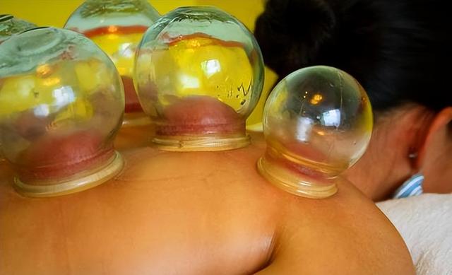 拔火罐吸出来的瘀血，是身体的毒素吗？告诉你真相，看完涨知识了