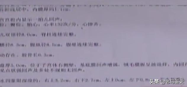 头胎刚满月，产妇马上又要生第二胎？医生：从医20年从未见过