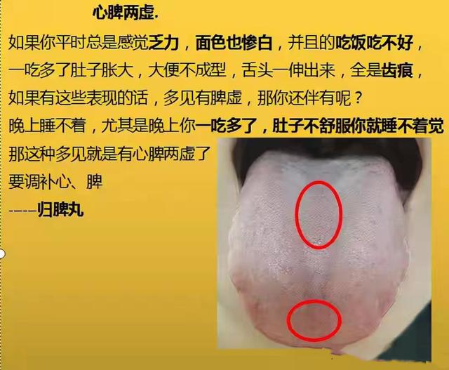 凌晨1—3点早醒，8种常见失眠类型，症状表现及实用中成药大总结