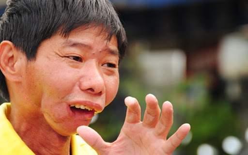 死亡與毀容，你選哪一個？6000萬國人的噩夢，造就了一大批割臉人
