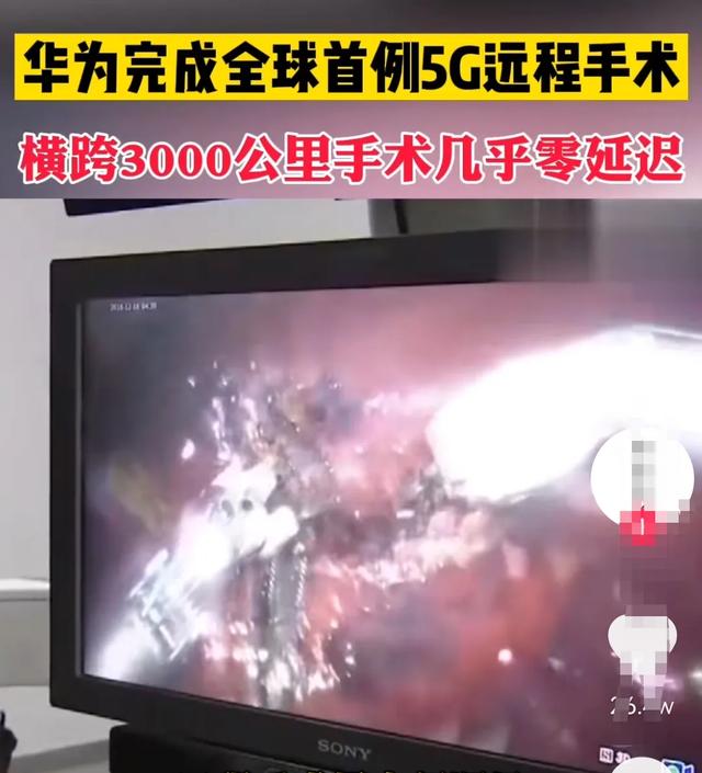 华为5G技术再次领先!完成全球首例5G远程手术:超远距离几乎零延迟-第5张图片-9158手机教程网