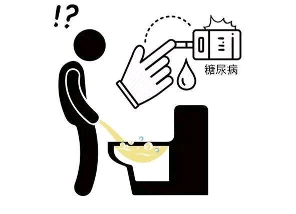 糖尿病泡沫尿时有时无，说明肾脏已受损？辟谣：不如做好这4件事