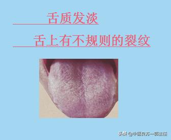 临床常见的9种舌象，对照自测
