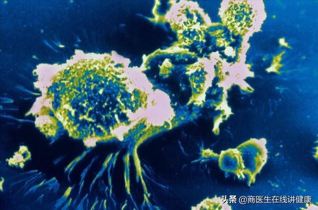 红薯到底是防治癌症还是致癌？它能降低血糖吗？医生告诉您真相
