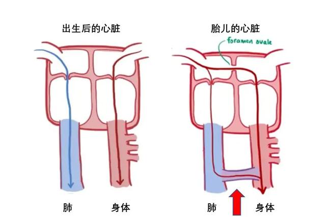 心脏是怎么长大的：第2篇——满是“漏洞”的心脏