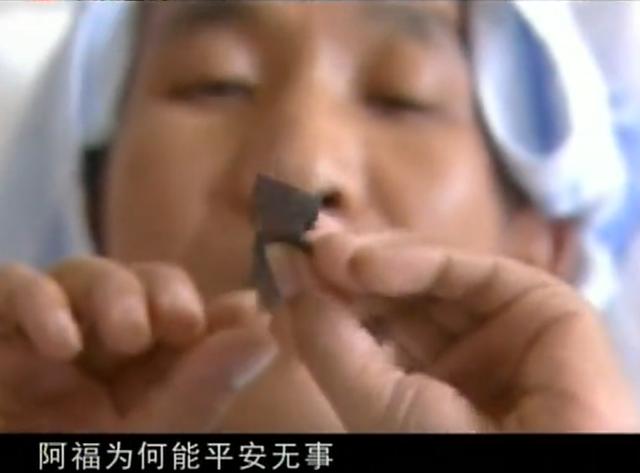 11年云南男子头疼呕吐，身上散发臭味，检查发现脑中插着一把匕首