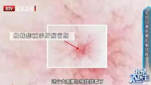 肝癌发生前身体给了3次补救机会！异常早发现，帮你及时“刹车”
