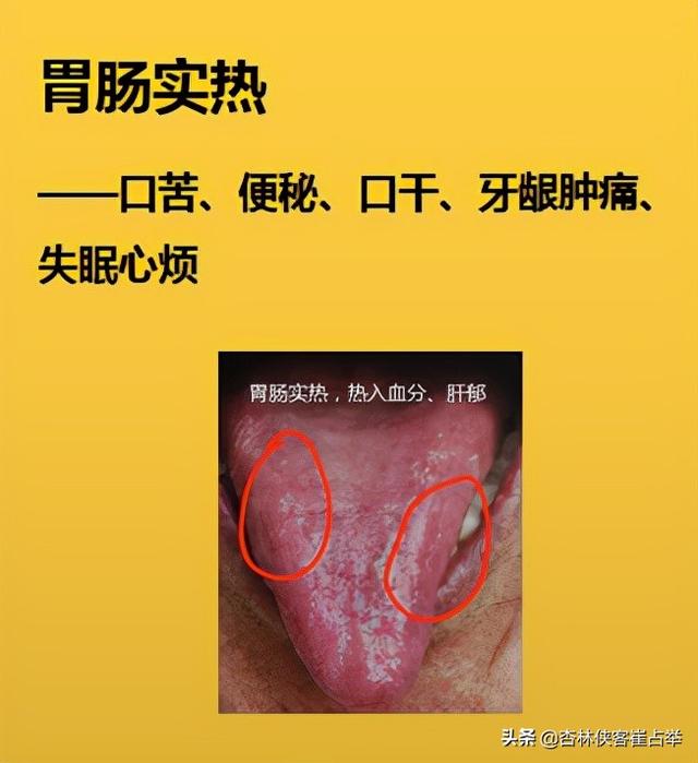 心火旺、肝火旺、胃火旺？看舌头发出的这些信号！提醒你要注意了