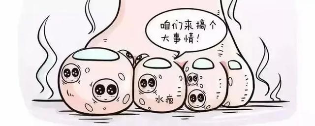 角化型脚气怎么治?角化型脚气