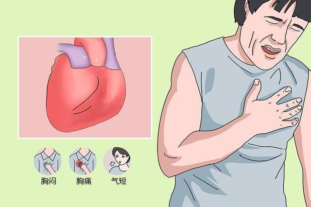 两种中成药，多靶点“清理血液”，从根上疏通冠脉，改善心肌缺血