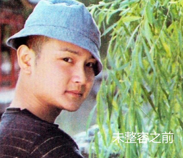 明星频翻车医美需谨慎！有人脸变充气气球，有人下巴变天气预报