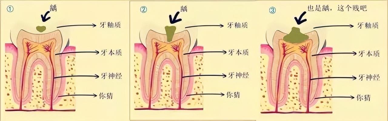 牙齿上有黑色的东西洗不掉怎么办