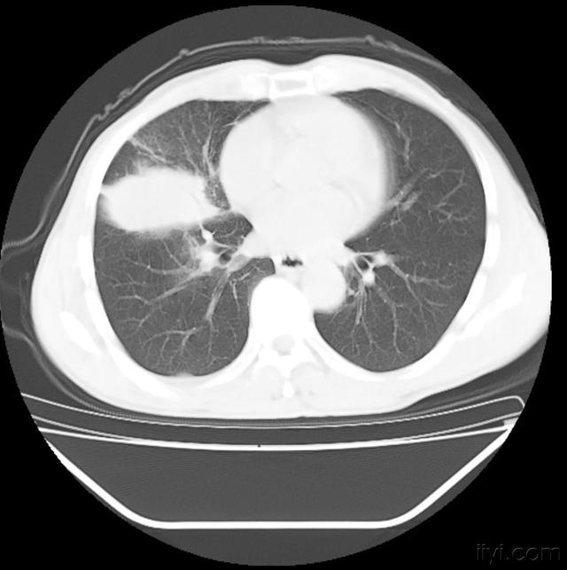 为什么院士都是长寿的命？并不是有秘诀在手，而是有5种长寿理念