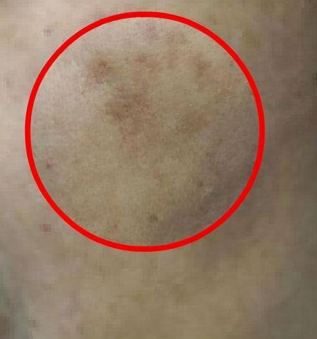 如何祛斑美白(如何祛斑美白偏方) 注册公司 第2张