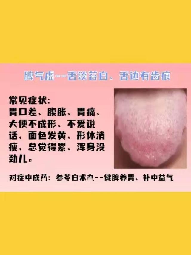 身体常见的几种虚证，建议了解