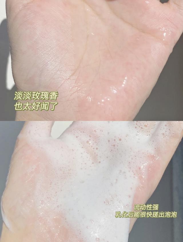 脚上脱皮抹身体乳能管用吗