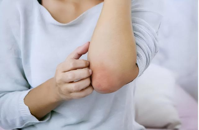 香椿吃多了是致癌，是谣言还是真相？如何正确的食用香椿