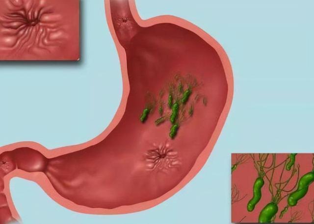 腐乳，对身体有好处吗？医生：并非人人都适合，4类人尽量别贪嘴