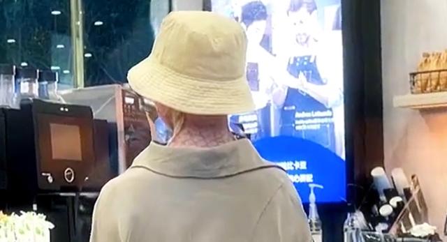 乔燕：因汽车自燃被烧伤，全脸毁容双手截肢，928天后涅槃重生