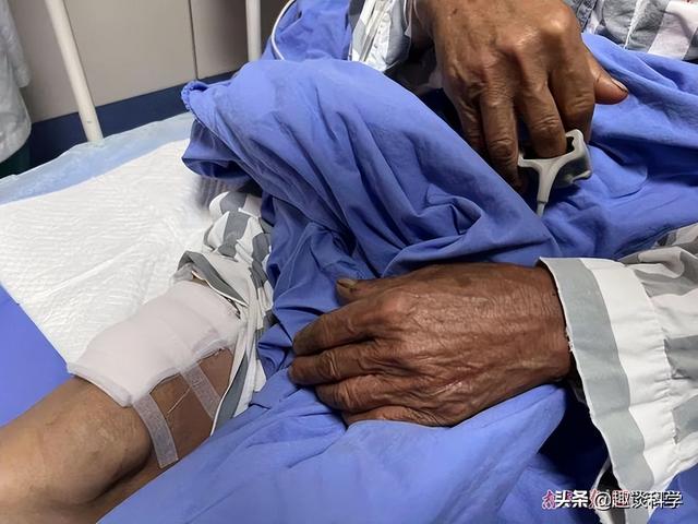 扔石头惹怒眼镜王蛇！七旬老伯被追咬，两招捡回一命，医生：万幸
