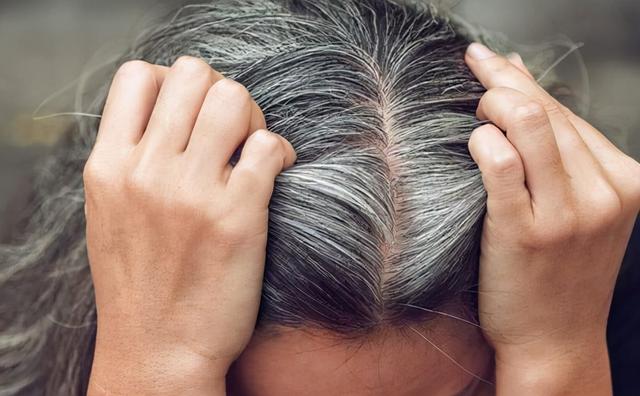 须发早白？一剂二至丸，益肾经，养肝血，凉血热，清上补下