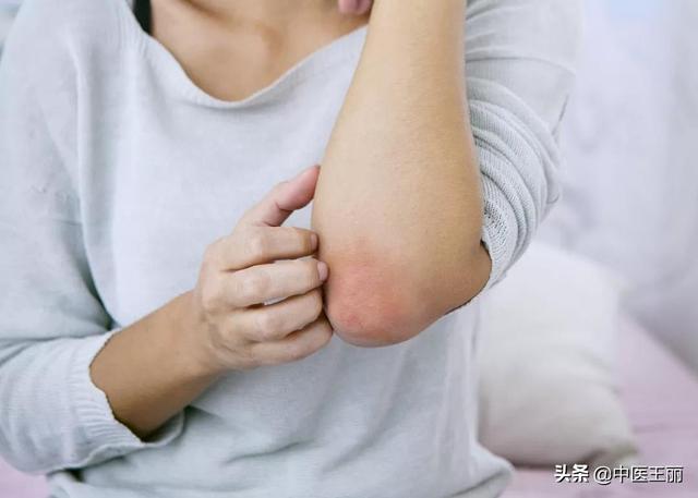 春季容易受风寒感冒、长湿疹？说一个方子，解表清热、除湿疹