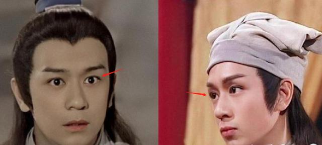 明星频翻车医美需谨慎！有人脸变充气气球，有人下巴变天气预报