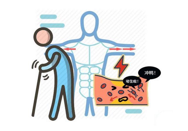 血液黏稠，血管不通，试试4种疏通血管的方法，预防血栓很有效