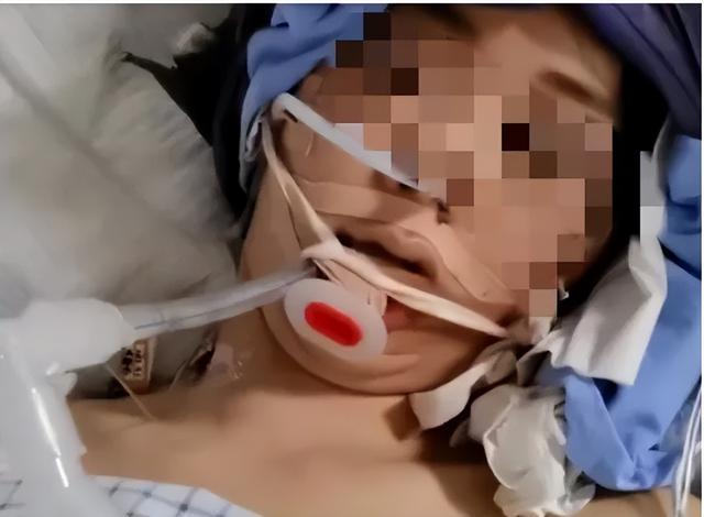 女子花近8万整容整出9级伤残 闵行网