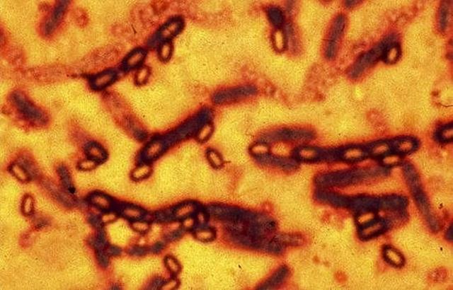北极发现5.7万年前尸体，可能还会出现更危险的东西，人类需警醒
