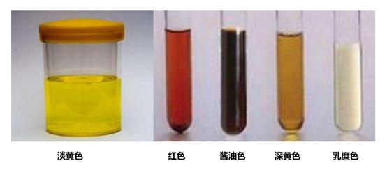 检查尿是阴性什么意思