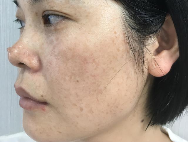 老药新用：逍遥丸、归脾丸、六味地黄丸，原来还能改善这些疾病