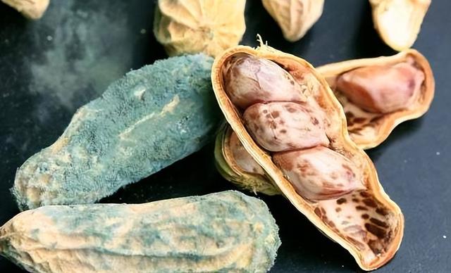 肝硬化的人或因面条吃多了？提醒：若想养肝，2种食物最好少吃