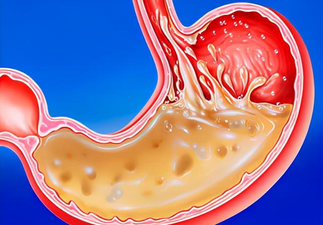 肚子经常咕咕叫，还总是放屁，是怎么回事？看完或对您有帮助