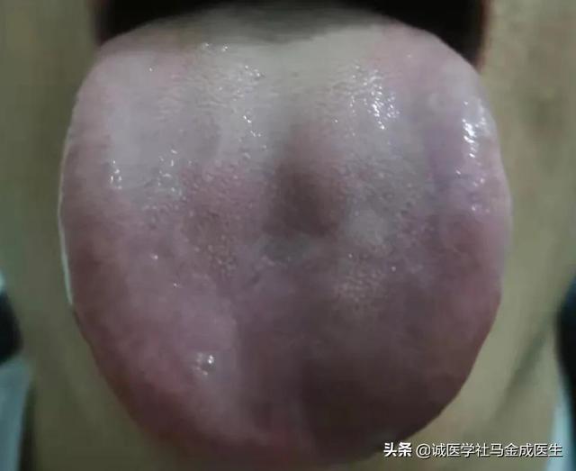 一吃凉的就胃痛？教你几个中成药，让你冷热酸甜，想吃就吃