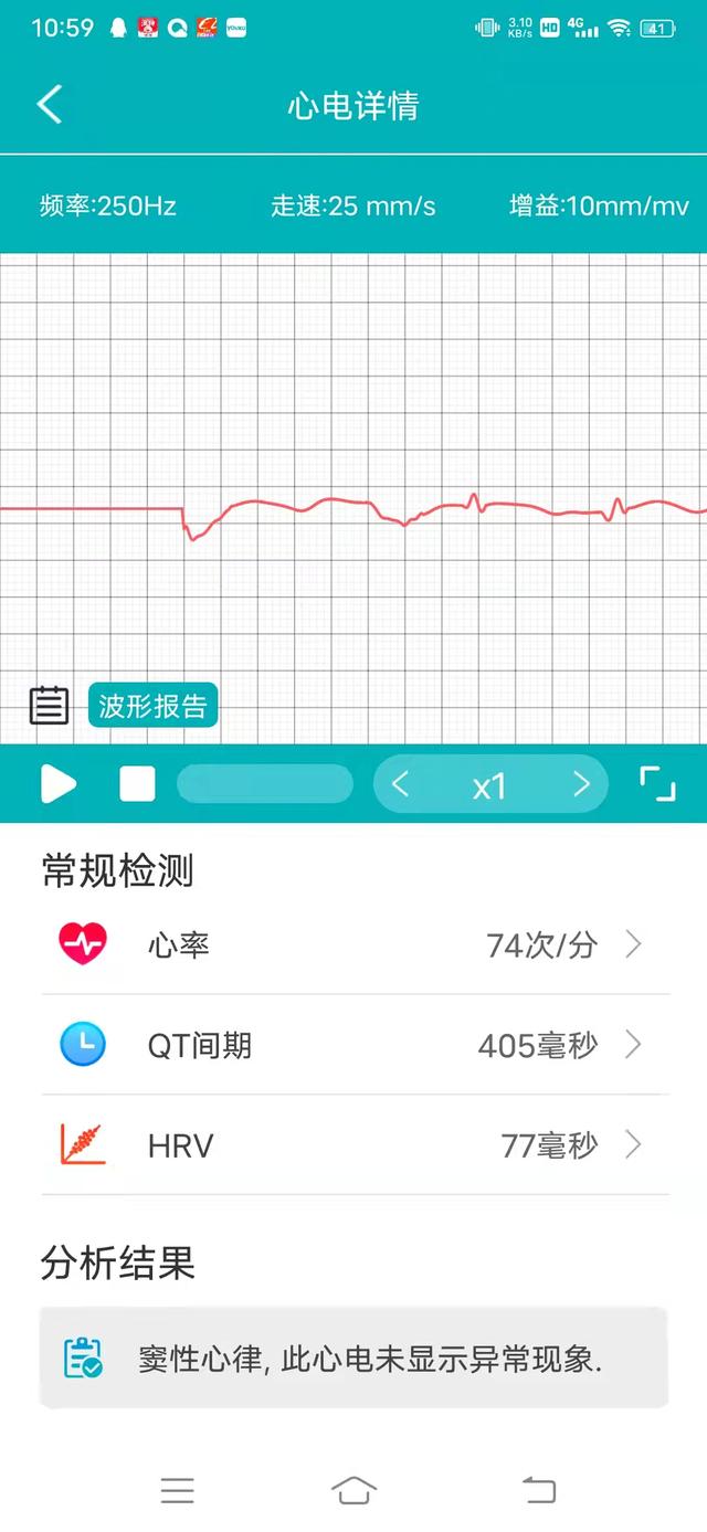 dido Y2S智能手环，高品质生活需要它