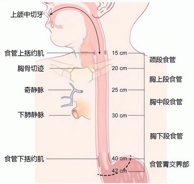中國食管癌放射治療指南 | 放療適應癥與放療計劃制定