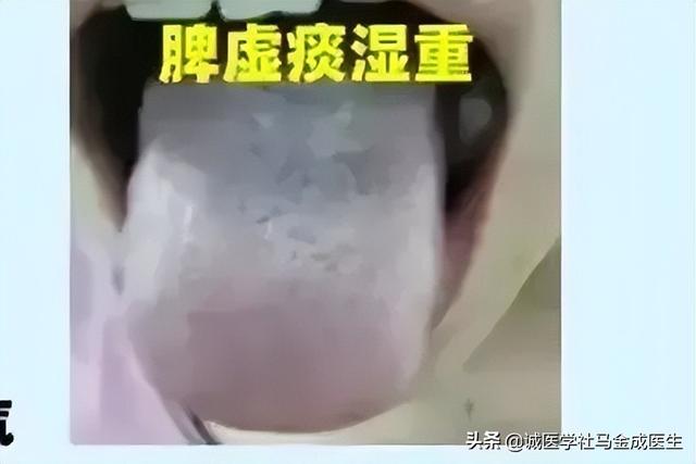常用调理脾胃的中成药应用大全，不下十几种，看看怎么区分？