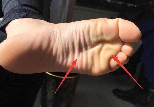 寿命长不长，低头看看脚？自查一下，你的脚是否有4个特征？