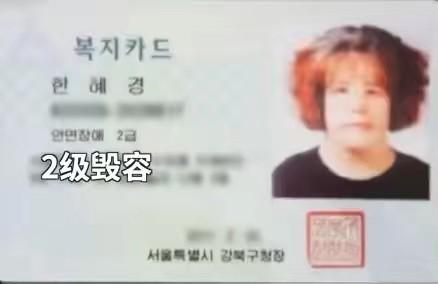 韩慧景：把自己整成“电风扇”，注射食用油代价惨痛，我悔不当初