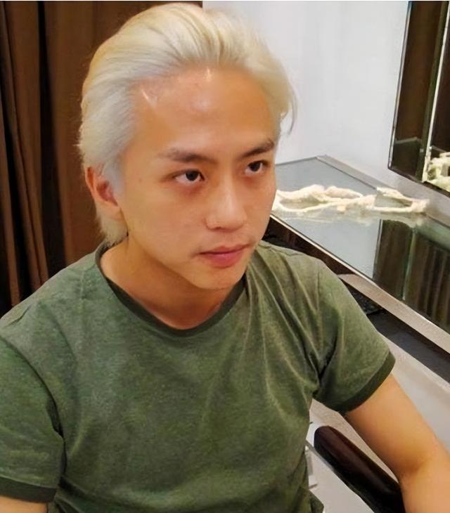白发长在哪，暗示病从哪出？长在两鬓、前额、后脑勺分别说明什么