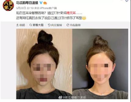 33岁女网红抽脂致死：醒醒吧，被容貌焦虑毁掉的女孩