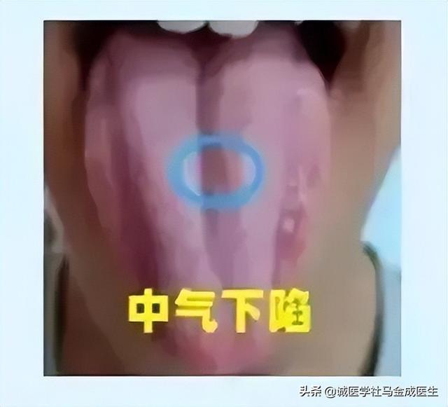 常用调理脾胃的中成药应用大全，不下十几种，看看怎么区分？