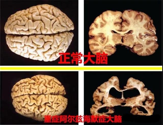 人类为何不能实现“永生”？科学家：人类只是在给基因打工罢了